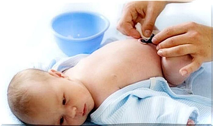 Caring for the newborn's umbilical cord