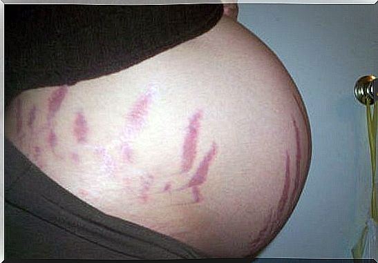 pregnancy spots