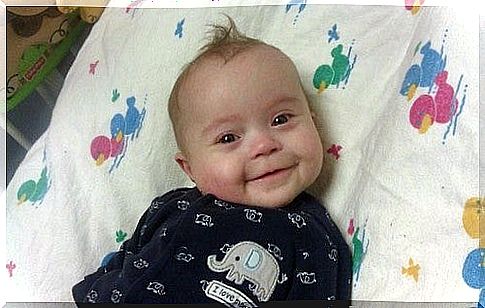 Torticollis in newborns.  Baby smiling on the cot.