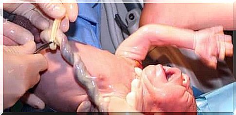 Newborn birth with umbilical cord.