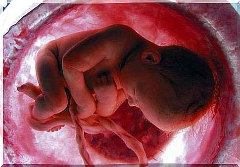 Prolapse of the umbilical cord: drawing of a baby in the womb.